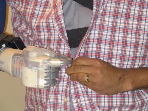 Measurement of success - Researchers have devised standardized methods and criteria for clinicians to grade patients’ performance, speed, and skill using any kind of prosthetic arm to do 18 everyday tasks.