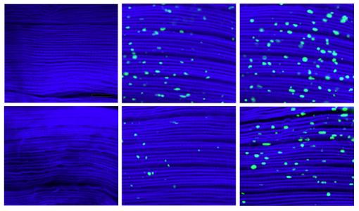 Messy muscle - More protein aggregates, shown as green specks, built up over 1, 3, and 5 weeks (left to right) in the muscle fibers of control flies (top row) compared to those in which dawdle, which hinders their cleanup, was suppressed.