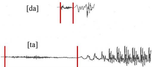 Ta Da! - The waveforms of two similar sounding syllables “ta” and “da” allow researchers to make precise time measurements and comparisons of speech production.