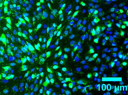 Beacons for bone - Glowing green spots in these MG-63 bone cells (each blue dot is a nucleus) indicate that a fluorescent “beacon” molecule has bound to RNA produced by expression of the bone-specific ALPL gene.