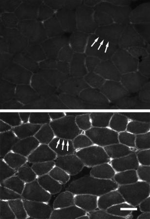 Keeping muscles strong - Muscle cells of untreated mice with muscular dystrophy (top) show little utrophin in cell walls. Muscles of mice treated with biglycan (bottom) have accumulated the protein utrophin.