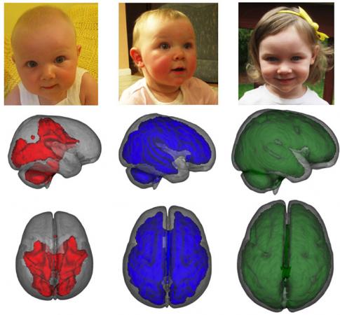 Support for the developing brain - MRI images, taken while children were asleep, showed that infants who were exclusively breastfed for at least three months had enhanced development in key parts of the brain compared to children who were fed formula or a combination of formula and breastmilk. Images show development of myelization by age, left to right.