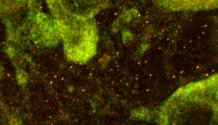 Knowing where the defects are - Fragile X granules (red dots) appear beside neuron cell bodies (green) in microscopy of mouse brain tissue. The granules could be useful as targets for new therapies in autism and mental retardation.