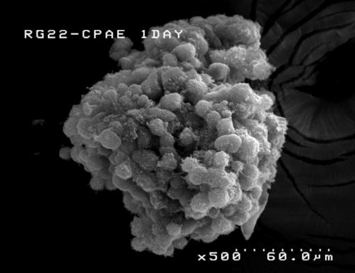 A natural assembly - The 3-D glioma model, developed at Brown University, allows the glioma and the supporting
endothelial cells to assemble naturally, just as they would in real
life.