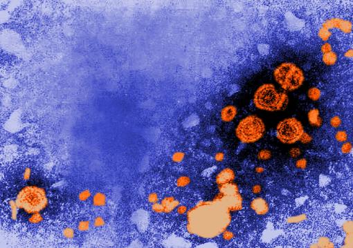 Missed opportunities - A transmission electron microscope image shows particles of the hepatitis B virus. A vaccine has existed since 1982 but many people at high risk for getting the virus nevertheless are not innoculated.