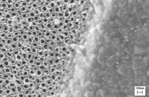 Nanotubular surfaces - Anodizing the titanium surface of a surgical implant, left, yields a roughened surface of nanotubes, which skin cells colonize more quickly.