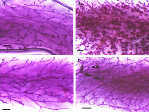 A striking degree of abnormal cell growth - Mammary tissue of control mice (left) and mice exposed as fetuses to 1,000 mg per kg of mother’s body weight of MEHP, a common ingredient in plastics. (Black bar is 1 mm.)