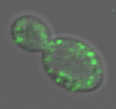 Less is more - Green spots in an infected yeast cell are fluorescent prion structures. The size of prion structures is crucial. Smaller structures move more efficiently between cells, so they are more likely to spread disease.