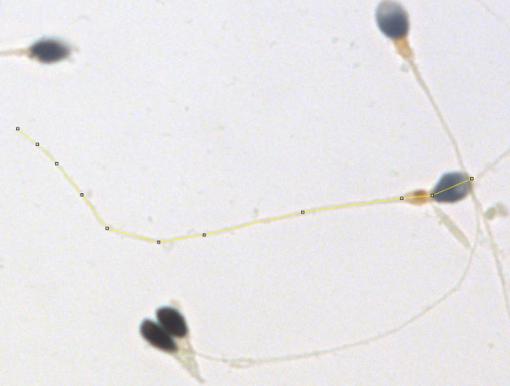 Good swimmers of uniform size - Variations in sperm length, particularly in the tail (flagellum), indicate a lower concentration of sperm that swim well. Researchers apply the segmented line to measure the length of the sperm.