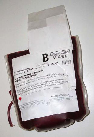 A risk not well understood - Some physicians think blood transfusion could increase the heart’s oxygen supply for anemic heart attack patients, but a new study suggests that extensive transfusion could increase the risk of death or a second heart attack.