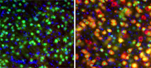Brain disrupted - Neurons from the thalamus of control mice with healthy genes glow green (left), while those whose two Tsc1 alleles were deleted during embryonic development show a strong red glow (right), indicating disruption of the mTOR pathway that regulates growth.