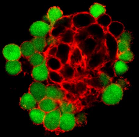 Ties that bind - Cancerous rat cells (black) expressing the protein Pannexin1 are bound
within a strong network of actin (red), while adjacent cells that don't
express Pannexin1 (green) have much less developed actin network around
them. (Click image for higher resolution.)