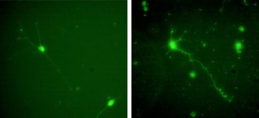 A more dependable scaffold for neural cell culture - Rat central nervous system cells cultured in the apoE4 protein (right) fare better, with more axons and dendrites than cells cultured in laminin (left). Ironically, apoE4 is associated with the neural deficits of Alzheimer's disease in the body.