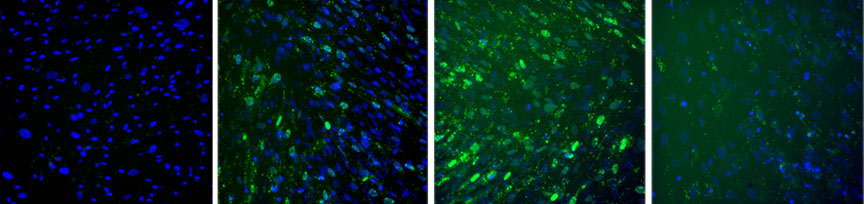 Time lapse: Becoming bone: A population of fat-derived stem cells expresses the bone-specific COL1A1 gene. Green fluorescence from a “molecular beacon” shows increasing expression from day 9, left, through day 11 and day 14. By day 16, right, expression begins to wane. Credit:&nbsp;Darling&nbsp;Lab/Brown&nbsp;University