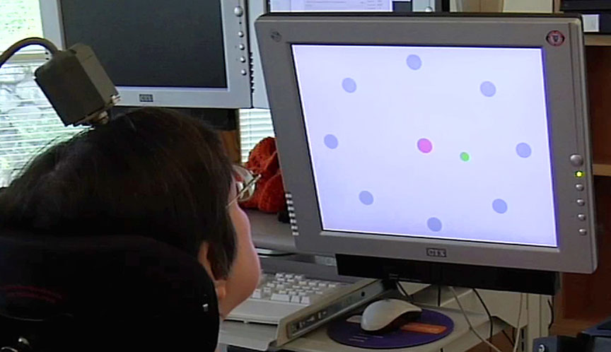 A brain-computer interface: A woman with paralysis controls a computer cursor on a screen by the neural activity of intending to move it with her arm and hand. The woman, identified as S3, used the investigational BrainGate system more than 1,000 days after the device was implanted.