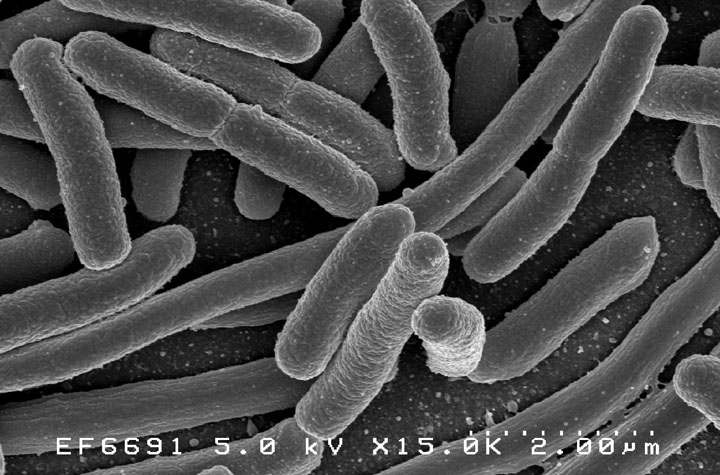 A major clinical problem, largely unknown to patients: People are said to die of cancer or other diseases, but the actual agent of death is often septic shock. There is no effective medicine, although treatment procedures have improved. Image&nbsp;of&nbsp;E.coli&nbsp;bacteria:&nbsp;National&nbsp;Institutes&nbsp;of&nbsp;Health