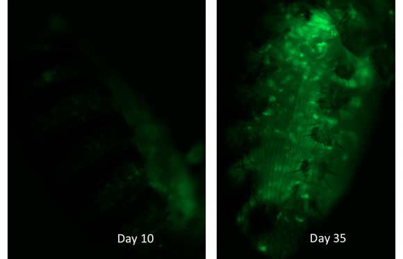 Activity with age Fluorescence in the fat body of fruit flies tracks the activity of transposable elements of DNA. It increases markedly with age. Jason Wood/Brown University